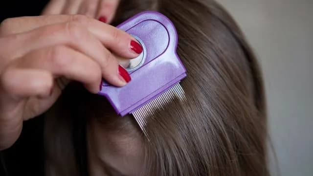 Kopfläuse: Eine Behandlung reicht nicht aus
